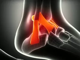 Descubre las causas y tratamientos del dolor lateral en el pie.
